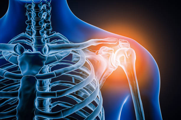 Best Joint Replacement Surgeon in sangamner